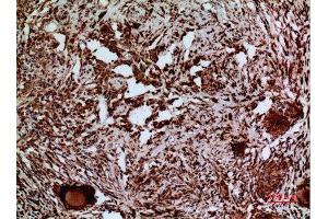 Immunohistochemistry (IHC) analysis of paraffin-embedded Human Lung, antibody was diluted at 1:100. (LAMC2 antibody  (C-Term))