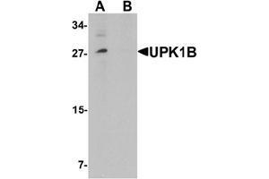 Western blot analysis of UPK1B in mouse bladder tissue lysate with UPK1B Antibody  at (A) 0.