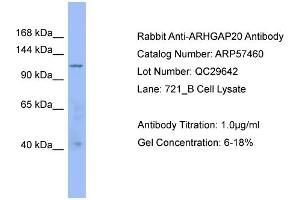 WB Suggested Anti-ARHGAP20  Antibody Titration: 0. (ARHGAP20 antibody  (Middle Region))