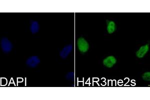 Immunofluorescence analysis of 293T cells using Symmetric DiMethyl-Histone H4-R3 antibody (ABIN3017488, ABIN3017489, ABIN3017490, ABIN1680265 and ABIN6220116). (Histone H4 antibody  (2meArg3))