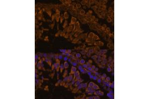 Immunofluorescence analysis of rat testis using ZPBP antibody (ABIN7271569) at dilution of 1:100. (ZPBP antibody  (AA 45-200))