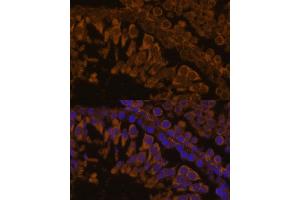 Immunofluorescence analysis of rat testis using ZPBP antibody (ABIN7271569) at dilution of 1:100. (ZPBP antibody  (AA 45-200))