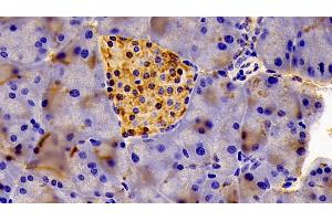 Immunohistochemistry (IHC) image for anti-Eukaryotic Translation Initiation Factor 2-alpha Kinase 3 (EIF2AK3) (AA 973-1114) antibody (ABIN7441241)