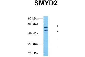 Host:  Rabbit  Target Name:  SMYD2  Sample Tissue:  Human 293T  Antibody Dilution:  1. (SMYD2A antibody  (Middle Region))
