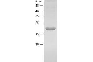 Western Blotting (WB) image for Glycoprotein Ib (Platelet), beta Polypeptide (GP1BB) (AA 26-206) protein (His tag) (ABIN7285359) (GP1BB Protein (AA 26-206) (His tag))