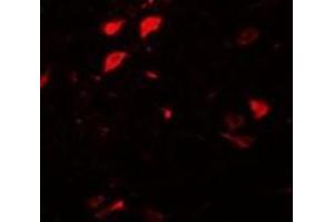 Immunofluorescence of DLCK3 in human brain tissue with AP30278PU-N DLCK3 antibody at 20 μg/ml. (DCLK3 antibody  (N-Term))
