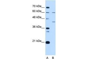 Western Blotting (WB) image for anti-Replication Factor C (Activator 1) 5, 36.5kDa (RFC5) antibody (ABIN2462953) (RFC5 antibody)