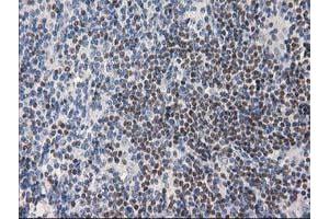 Image no. 6 for anti-Ankyrin Repeat Domain 53 (ANKRD53) (AA 1-300) antibody (ABIN1490720) (ANKRD53 antibody  (AA 1-300))