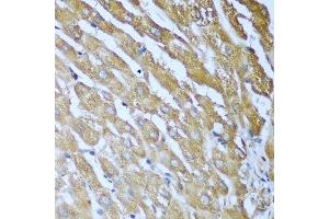 Immunohistochemistry (Paraffin-embedded Sections) (IHC (p)) image for anti-Insulin-Like Growth Factor 2 mRNA Binding Protein 3 (IGF2BP3) (AA 1-200) antibody (ABIN3016599)