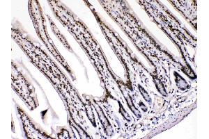 Immunohistochemistry (IHC) image for anti-High Mobility Group Box 1 (HMGB1) (AA 124-154), (C-Term) antibody (ABIN5518759)