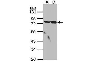 WB Image Sample(30 μg of whole cell lysate) A:A431, B:H1299 10% SDS PAGE antibody diluted at 1:1500 (SSX2IP antibody  (C-Term))