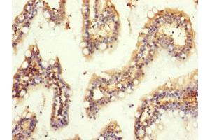 Immunohistochemistry of paraffin-embedded human small intestine tissue using ABIN7154692 at dilution of 1:100 (GNB2 antibody  (AA 1-340))