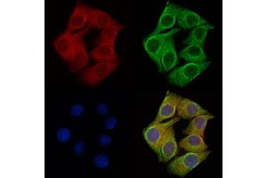 ABIN6257431 and ABIN6275975 staining Hela cells by IF/ICC. (PTH1R antibody  (Internal Region))
