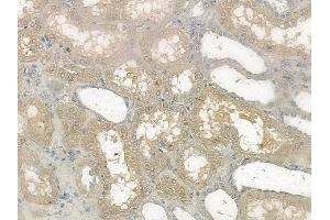 ABIN6256465 and ABIN6267170 at 1/100 staining human normal kidney tissue by IHC-P. (RICTOR antibody  (pThr1135))