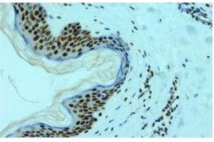 Image no. 3 for anti-Heterogeneous Nuclear Ribonucleoprotein L (HNRNPL) antibody (ABIN108588) (HNRNPL antibody)