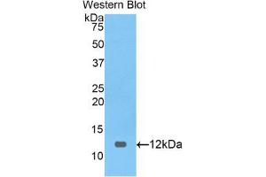 Western blot analysis of the recombinant protein. (PRAME antibody  (AA 416-502))