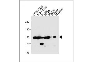 All lanes : Anti-NOD1 Antibody (C-term) at 1:2000 dilution Lane 1: CCRF-CEM whole cell lysate Lane 2: NCI- whole cell lysate Lane 3: HL-60 whole cell lysate Lane 4: HT-29 whole cell lysate Lane 5: S whole cell lysate Lane 6: Mouse heart lysate Lane 7: Mouse spleen lysate Lysates/proteins at 20 μg per lane. (NOD1 antibody  (C-Term))
