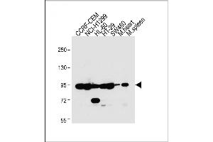 All lanes : Anti-NOD1 Antibody (C-term) at 1:2000 dilution Lane 1: CCRF-CEM whole cell lysate Lane 2: NCI- whole cell lysate Lane 3: HL-60 whole cell lysate Lane 4: HT-29 whole cell lysate Lane 5: S whole cell lysate Lane 6: Mouse heart lysate Lane 7: Mouse spleen lysate Lysates/proteins at 20 μg per lane.