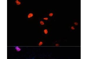 Immunofluorescence analysis of U-2 OS cells using KDM3A Polyclonal Antibody at dilution of 1:100 (40x lens). (KDM3A antibody)