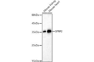 Western blot analysis of extracts of various cell lines, using SFRP2 antibody (ABIN6131355, ABIN6147675, ABIN6147677 and ABIN6221030) at 1:1000 dilution.