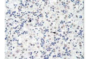 Image no. 1 for anti-Squamous Cell Carcinoma Antigen Recognized By T Cells 3 (SART3) (N-Term) antibody (ABIN203084) (SART3 antibody  (N-Term))