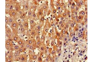 Immunohistochemistry of paraffin-embedded human liver tissue using ABIN7145367 at dilution of 1:100 (B3GALT2 antibody  (AA 201-422))
