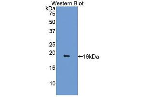 Western blot analysis of the recombinant protein. (ACVR2A antibody  (AA 20-95))
