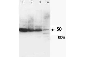 Western Blot analysis of CCR6 expression from cell and tissue extracts with CCR6 polyclonal antibody .