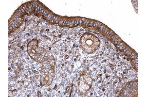 IHC-P Image T-Plastin antibody detects T-Plastin protein at cytoplasm on mouse cervix by immunohistochemical analysis. (Plastin 3 antibody)