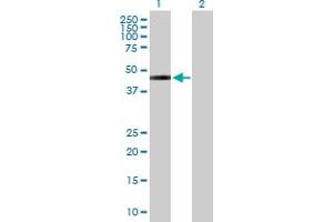 Lane 1: SLC16A1 transfected lysate ( 54 KDa) Lane 2: Non-transfected lysate.