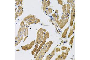 Immunohistochemistry of paraffin-embedded rat heart using MYO10 antibody (ABIN5974593) (40x lens). (Myosin X antibody)