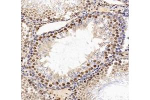 Immunohistochemistry analysis of paraffin-embedded rat testis using HNRNPM (ABIN7074247) at dilution of 1: 4000 (HnRNP M1-M4 antibody)