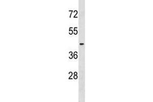 S1PR2 antibody western blot analysis in NCI-H292 lysate. (S1PR2 antibody  (AA 272-298))