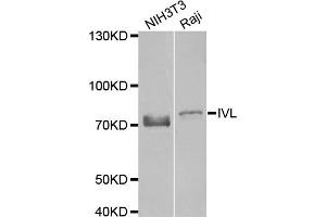 Western blot analysis of extracts of NIH3T3 and Raji cell lines, using IVL antibody. (Involucrin antibody)