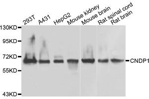 Western blot analysis of extracts of various cell lines, using CNDP1 antibody (ABIN4903321) at 1:1000 dilution. (CNDP1 antibody)