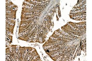 ABIN7094426 and ABIN7098473 at 1/100 staining Rat colorectal tissue by IHC-P. (COPB1 antibody  (Internal Region))