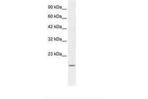 Image no. 2 for anti-BCL2-Associated X Protein (BAX) (N-Term) antibody (ABIN202051) (BAX antibody  (N-Term))