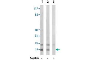 Western blot analysis of extracts from HepG2 cells (Lane 1 and lane 3) and HeLa cells (Lane 2), using RPL12 polyclonal antibody .