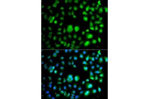 Immunofluorescence analysis of A549 cells using TET3 antibody. (TET3 antibody)