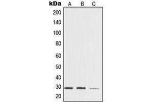 Western blot analysis of 14-3-3 zeta expression in HeLa (A), mouse brain (B), rat kidney (C) whole cell lysates. (14-3-3 zeta antibody  (Center))