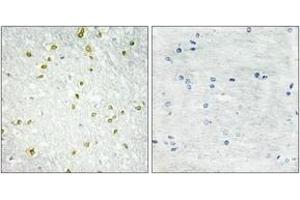 Immunohistochemistry analysis of paraffin-embedded human brain tissue, using SNAPC5 Antibody. (SNAPC5 antibody  (AA 10-59))