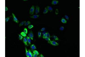 Immunofluorescent analysis of HepG2 cells using ABIN7145066 at dilution of 1:100 and Alexa Fluor 488-congugated AffiniPure Goat Anti-Rabbit IgG(H+L) (DARC antibody  (AA 1-63))