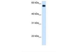 Image no. 2 for anti-Aldehyde Dehydrogenase 4 Family, Member A1 (ALDH4A1) (C-Term) antibody (ABIN320974) (ALDH4A1 antibody  (C-Term))