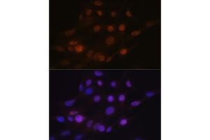 Immunofluorescence analysis of C6 cells using B Rabbit mAb (ABIN7265377) at dilution of 1:100 (40x lens). (ANP32B antibody)