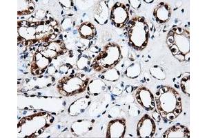 Immunohistochemical staining of paraffin-embedded Kidney tissue using anti-FAHD2Amouse monoclonal antibody.
