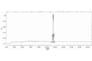 Image no. 2 for Procollagen III N-Terminal Propeptide (PIIINP) (N-Term) peptide (Ovalbumin) (ABIN5666357) (Procollagen III N-Terminal Propeptide (PIIINP) (N-Term) peptide (Ovalbumin))