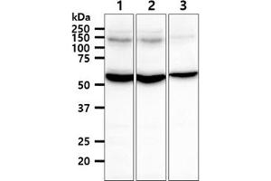 The cell lysates (40ug) were resolved by SDS-PAGE, transferred to PVDF membrane and probed with anti-human TXNRD1 antibody (1:1000).
