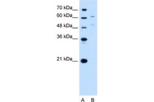 Western Blotting (WB) image for anti-UDP Glucuronosyltransferase 1 Family, Polypeptide A4 (UGT1A4) antibody (ABIN2463019) (UGT1A4 antibody)