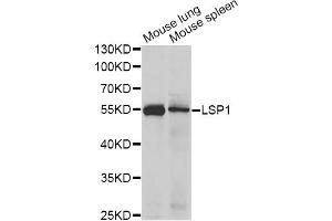 Western blot analysis of extracts of various cell lines, using LSP1 antibody (ABIN5973271) at 1/1000 dilution. (LSP1 antibody)