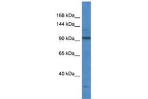 Image no. 1 for anti-Transcription Termination Factor, RNA Polymerase I (TTF1) (AA 412-461) antibody (ABIN6746964) (TTF1 antibody  (AA 412-461))